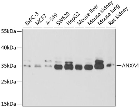 Western blot - ANXA4 Polyclonal Antibody 