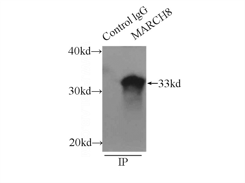 IP Result of anti-MARCH8 (IP:Catalog No:112446, 3ug; Detection:Catalog No:112446 1:400) with mouse lung tissue lysate 4000ug.