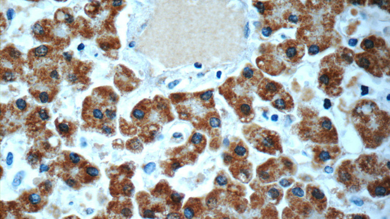 Immunohistochemistry of paraffin-embedded human liver slide using Catalog No:113686(PCCA Antibody) at dilution of 1:50