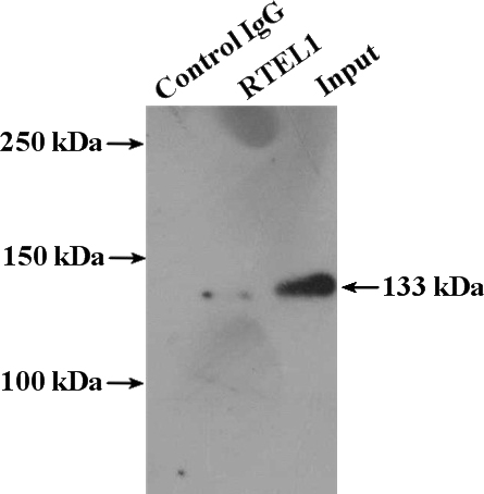 IP Result of anti-RTEL1 (IP:Catalog No:114857, 4ug; Detection:Catalog No:114857 1:500) with mouse brain tissue lysate 4000ug.