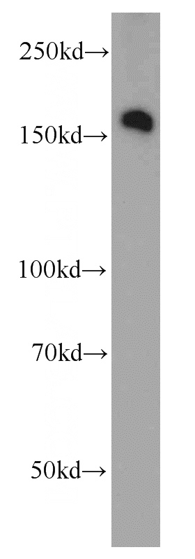 HT-1080 cells were subjected to SDS PAGE followed by western blot with Catalog No:114779(RocK2 antibody) at dilution of 1:1000