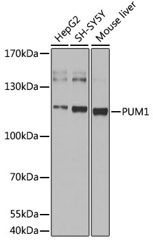 Western blot - pum1 Polyclonal Antibody 