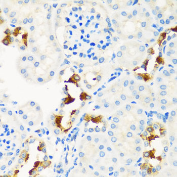 Immunohistochemistry - CPT2 Polyclonal Antibody 