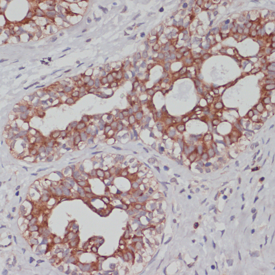 Immunohistochemistry - TPD52 Polyclonal Antibody 
