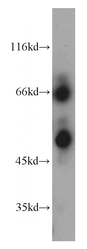 DU 145 cells were subjected to SDS PAGE followed by western blot with Catalog No:111457(HPSE antibody) at dilution of 1:300