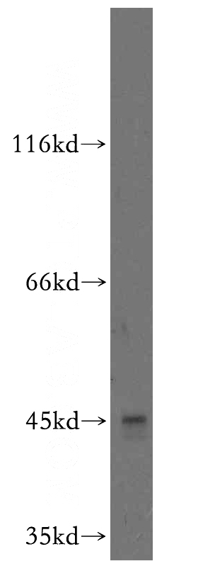 BxPC-3 cells were subjected to SDS PAGE followed by western blot with Catalog No:115882(TBRG1 antibody) at dilution of 1:300