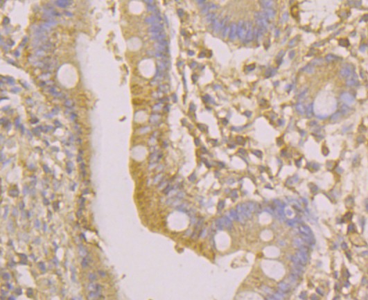 Fig4: Immunohistochemical analysis of paraffin-embedded human small intestine tissue using anti-Osteoprotegerin antibody. Counter stained with hematoxylin.