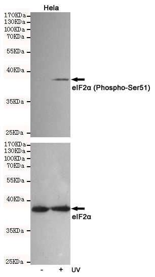 Western blot analysis of extracts from Hela cells, untreated or treated with UV, using eIF2u03b1 (Phospho-Ser51) Rabbit pAb (166690,1:500 diluted,upper) or eIF2u03b1 Mouse mAb (201137,lower).