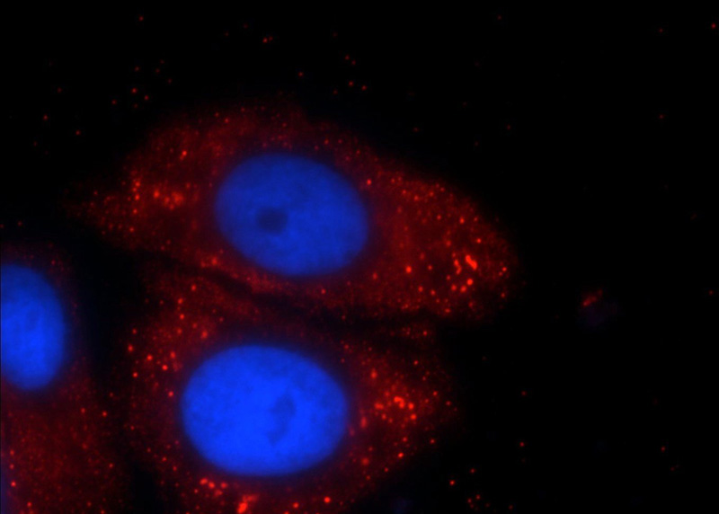 Immunofluorescent analysis of HepG2 cells using Catalog No:108736(C5orf26 Antibody) at dilution of 1:25 and Rhodamine-Goat anti-Rabbit IgG