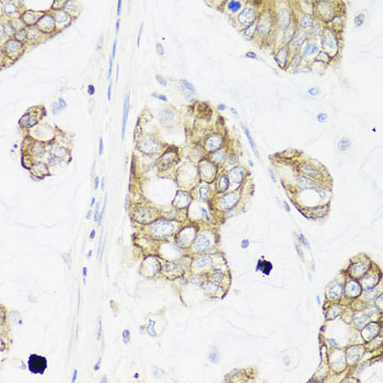 Immunohistochemistry - IER3 Polyclonal Antibody 