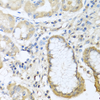 Immunohistochemistry - CCL11 Polyclonal Antibody 