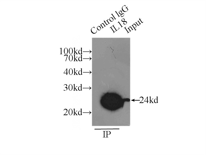 IP Result of anti-Pre-IL18 (IP:Catalog No:114182, 3ug; Detection:Catalog No:114182 1:1000) with HeLa cells lysate 5000ug.