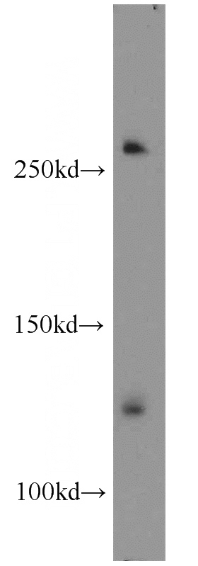 A431 cells were subjected to SDS PAGE followed by western blot with Catalog No:114597(RBM12B antibody) at dilution of 1:300