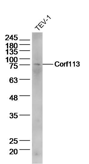 Fig1: Sample:TEV-1(human)cell Lysate at 30 ug; Primary: Anti-Corf113 at 1/300 dilution; Secondary: IRDye800CW Goat Anti-Rabbit IgG at 1/20000 dilution; Predicted band size: 71kD; Observed band size: 71 kD