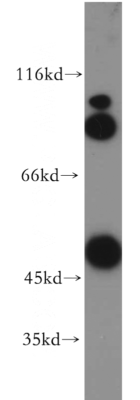 mouse liver tissue were subjected to SDS PAGE followed by western blot with Catalog No:110905(GCK antibody) at dilution of 1:500