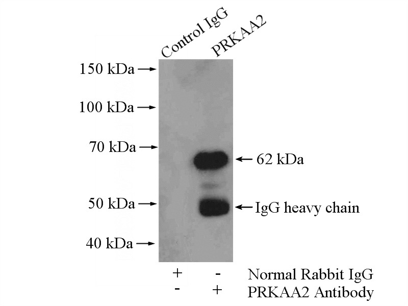 IP Result of anti-PRKAA2 (IP:Catalog No:108007, 4ug; Detection:Catalog No:108007 1:1000) with mouse skeletal muscle tissue lysate 3600ug.