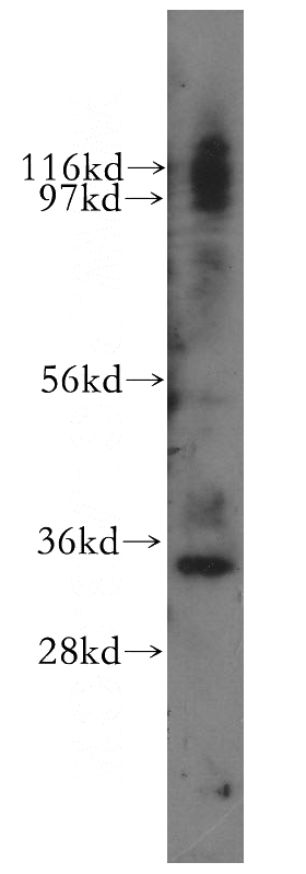 human brain tissue were subjected to SDS PAGE followed by western blot with Catalog No:116013(TFIIE beta antibody) at dilution of 1:800