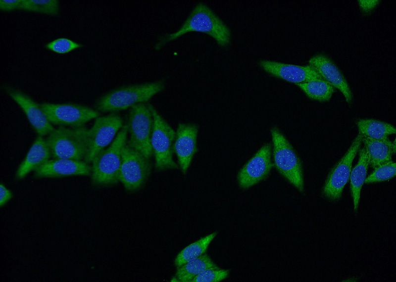 Immunofluorescent analysis of HeLa cells using Catalog No:116626(UPF3A Antibody) at dilution of 1:50 and Alexa Fluor 488-congugated AffiniPure Goat Anti-Rabbit IgG(H+L)