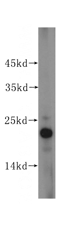 mouse small intestine tissue were subjected to SDS PAGE followed by western blot with Catalog No:109342(CLDN4-specific antibody) at dilution of 1:300