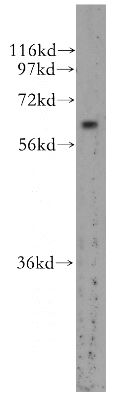 human brain tissue were subjected to SDS PAGE followed by western blot with Catalog No:117172(ZNF395 antibody) at dilution of 1:400