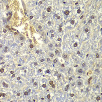 Immunohistochemistry - RPL5 Polyclonal Antibody 