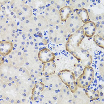 Immunohistochemistry - MTERFD3 Polyclonal Antibody 