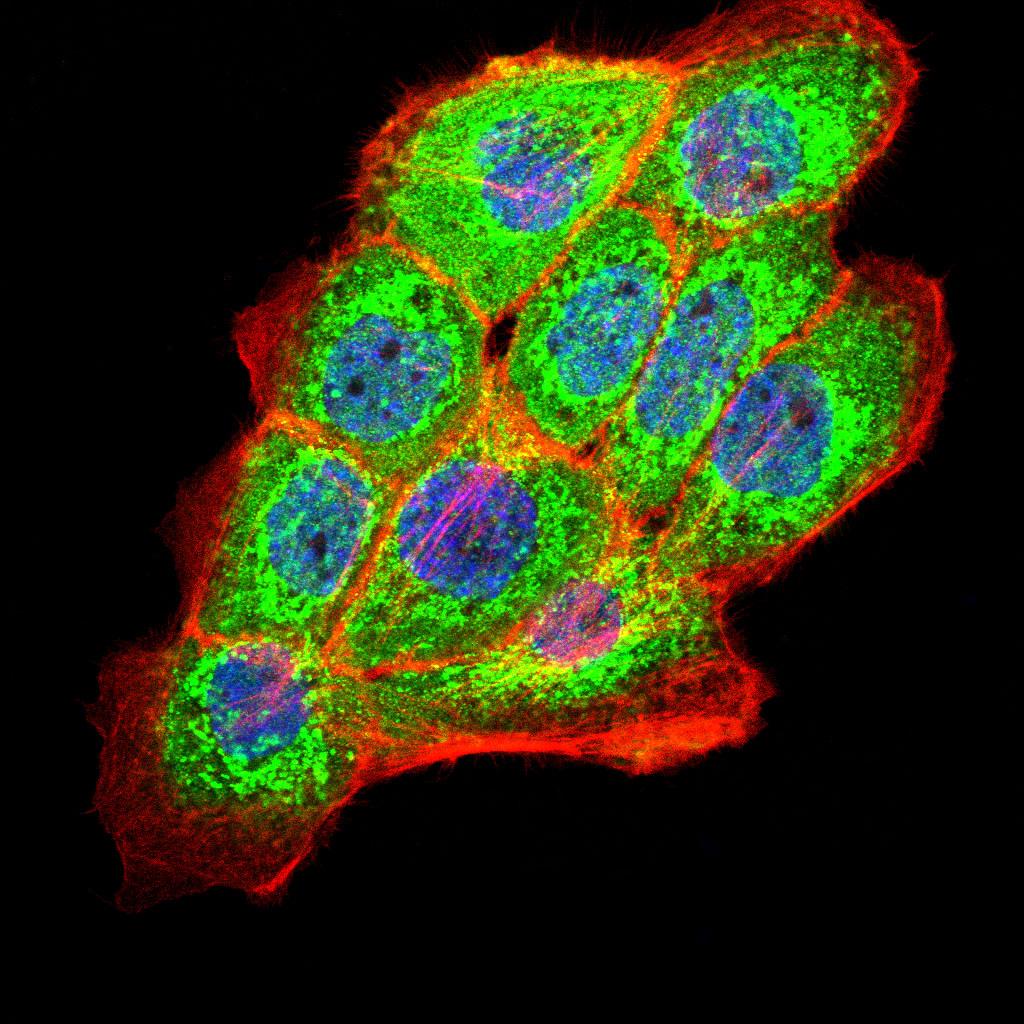Fig1: ICC staining PKHD1 (green) and Actin filaments (red) in A431 cells. The nuclear counter stain is DAPI (blue). Cells were fixed in paraformaldehyde, permeabilised with 0.25% Triton X100/PBS.