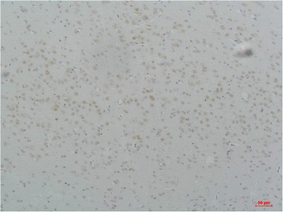 Fig1:; Immunohistochemical analysis of paraffin-embedded Rat Brain Tissue using Cav3.2Rabbit pAb diluted at 1:200.