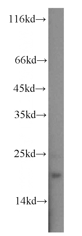 mouse brain tissue were subjected to SDS PAGE followed by western blot with Catalog No:115726(STMN2 antibody) at dilution of 1:2000