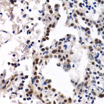 Immunohistochemistry - ID3 Polyclonal Antibody 