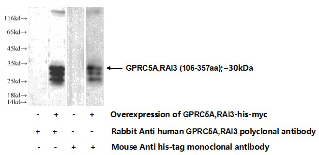 Transfected HEK-293 cells were subjected to SDS PAGE followed by western blot with Catalog No:111139(GPRC5A,RAI3 Antibody) at dilution of 1:700
