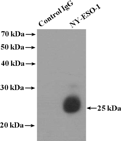 IP Result of anti-NY-ESO-1 (IP:Catalog No:113457, 4ug; Detection:Catalog No:113457 1:500) with HepG2 cells lysate 3200ug.