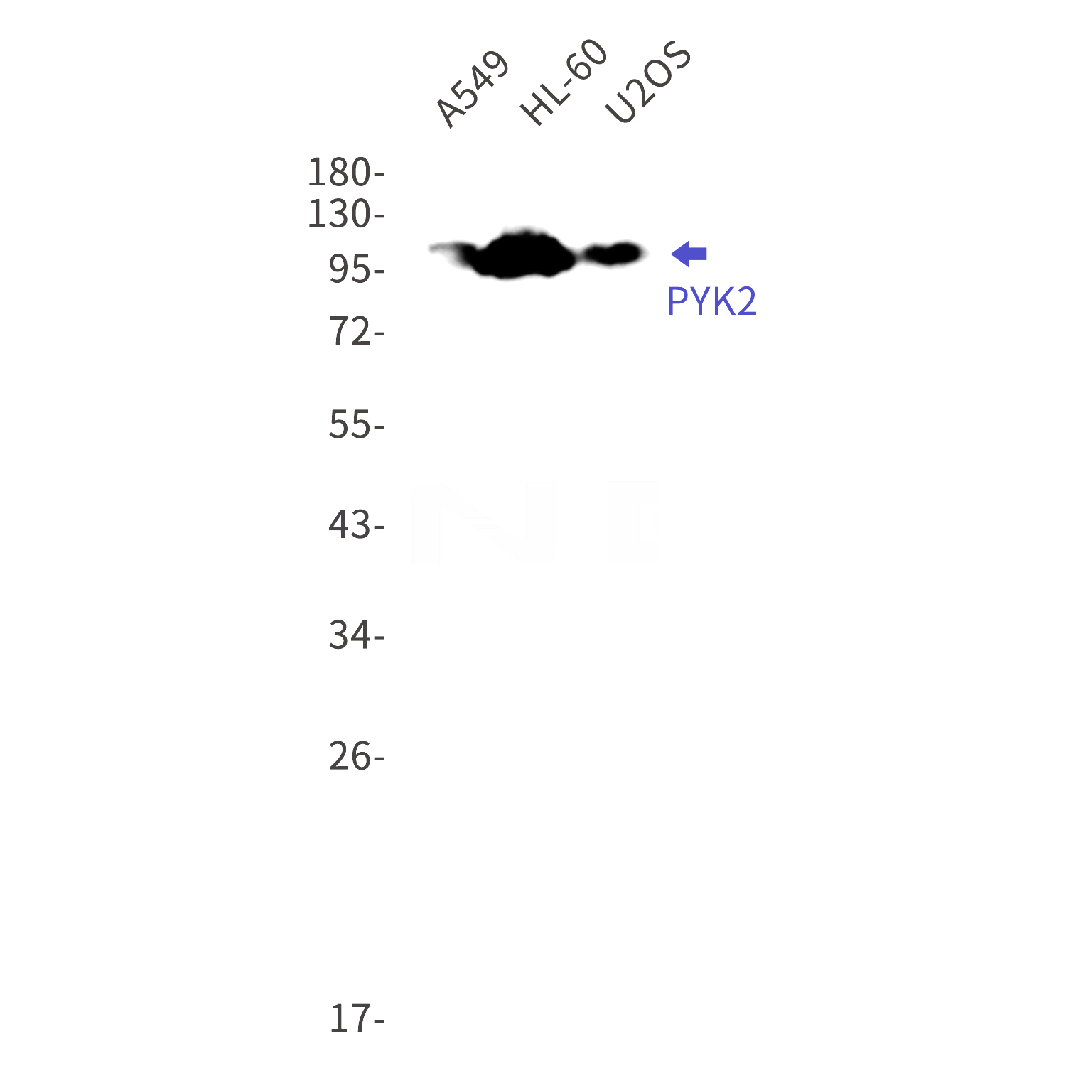 Western blot detection of PYK2 in A549,HL-60,U2OS cell lysates using PYK2 Rabbit mAb(1:1000 diluted).Predicted band size:116kDa.Observed band size:116kDa.