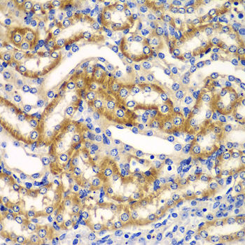 Immunohistochemistry - ZFAND3 Polyclonal Antibody 
