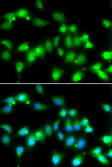 Immunofluorescence - AKAP5 Polyclonal Antibody 