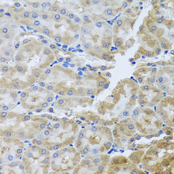 Immunohistochemistry - PER1 Polyclonal Antibody 