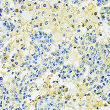 Immunohistochemistry - SLC25A1 Polyclonal Antibody 