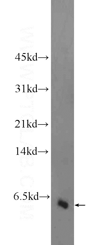 fetal human brain tissue were subjected to SDS PAGE followed by western blot with Catalog No:110852(GALP Antibody) at dilution of 1:300