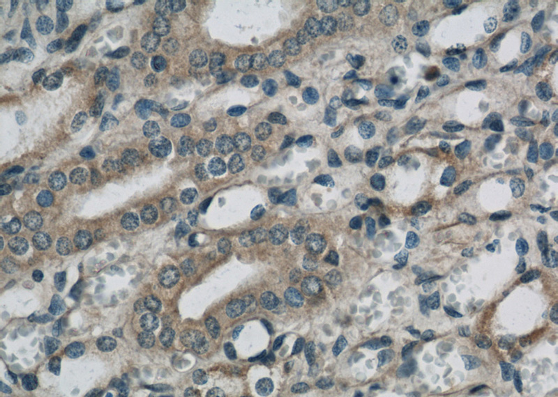 Immunohistochemical of paraffin-embedded human kidney using Catalog No:115069(ZFYVE9 antibody) at dilution of 1:50 (under 40x lens)