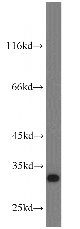 SH-SY5Y cells were subjected to SDS PAGE followed by western blot with Catalog No:109234(CHMP2B antibody) at dilution of 1:1000