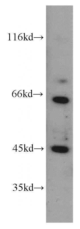 HeLa cells were subjected to SDS PAGE followed by western blot with Catalog No:116425(TSC22D4 antibody) at dilution of 1:200