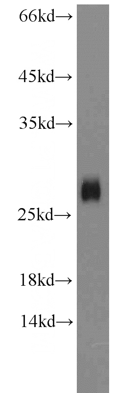 mouse brain tissue were subjected to SDS PAGE followed by western blot with Catalog No:115274(SHISA4 antibody) at dilution of 1:2000