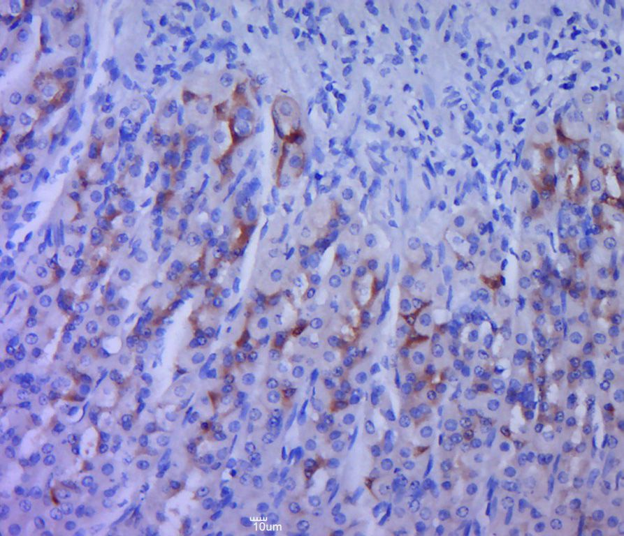 Fig5: Paraformaldehyde-fixed, paraffin embedded (rat stomach tissue); Antigen retrieval by boiling in sodium citrate buffer (pH6.0) for 15min; Block endogenous peroxidase by 3% hydrogen peroxide for 20 minutes; Blocking buffer (normal goat serum) at 37℃ for 30min; Antibody incubation with (5HT2A Receptor) Polyclonal Antibody, Unconjugated at 1:400 overnight at 4℃, followed by a conjugated secondary (sp-0023) for 20 minutes and DAB staining.