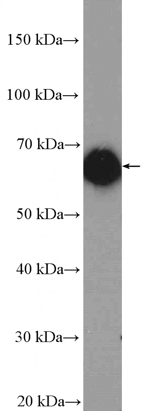 mouse brain tissue were subjected to SDS PAGE followed by western blot with Catalog No:108186(ARHGEF4 Antibody) at dilution of 1:1000
