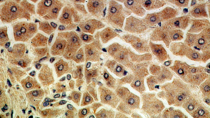 Immunohistochemical of paraffin-embedded human hepatocirrhosis using Catalog No:116644(URM1 antibody) at dilution of 1:100 (under 40x lens)