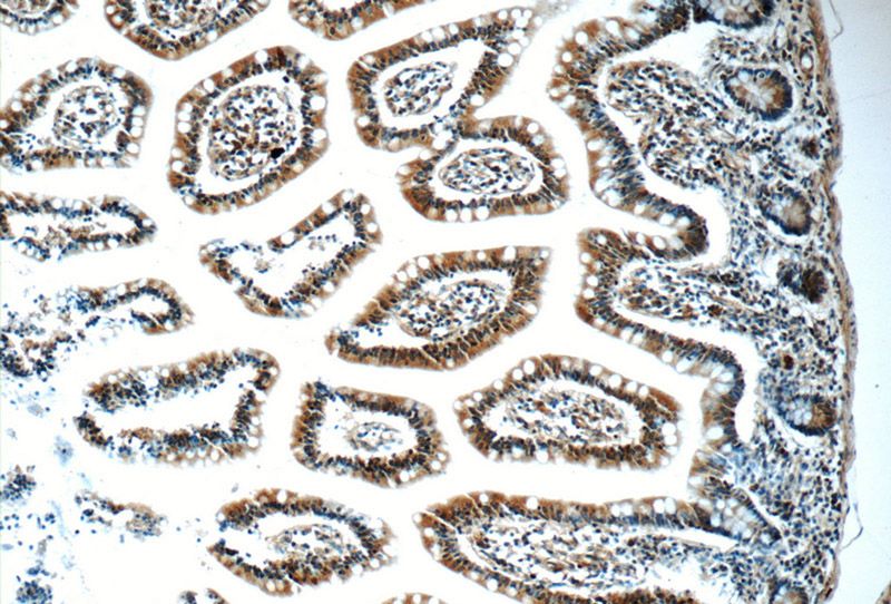 Immunohistochemistry of paraffin-embedded human small intestine tissue slide using Catalog No:114853(RSRC1 Antibody) at dilution of 1:50 (under 10x lens)