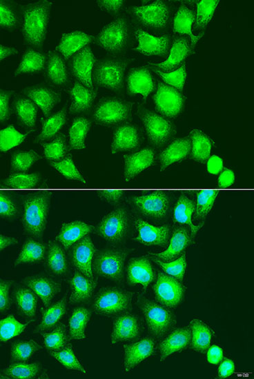 Immunofluorescence - UBIAD1 Polyclonal Antibody 