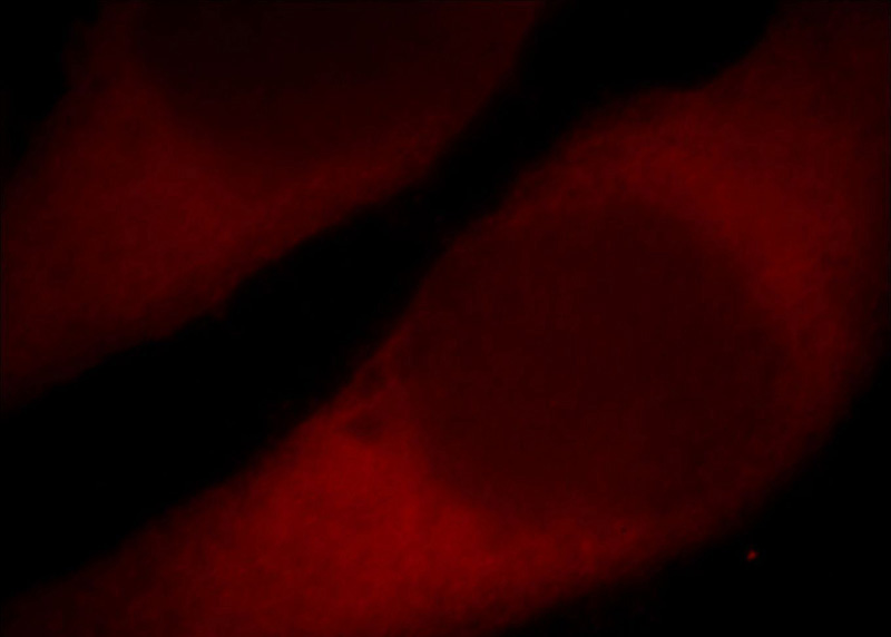 Immunofluorescent analysis of Hela cells, using CYP2E1 antibody Catalog No:109694 at 1:25 dilution and Rhodamine-labeled goat anti-rabbit IgG (red).