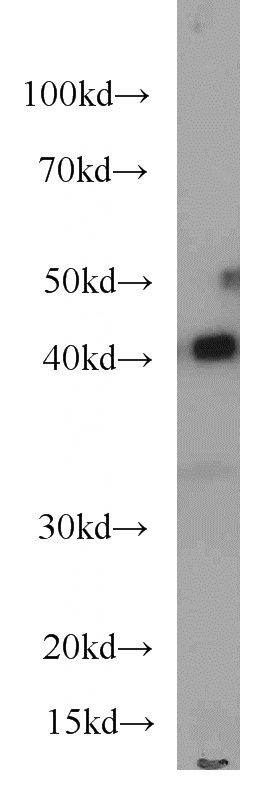 HeLa cells were subjected to SDS PAGE followed by western blot with Catalog No:107068(ASS1 antibody) at dilution of 1:500