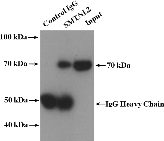 IP Result of anti-SMTNL2 (IP:Catalog No:115403, 4ug; Detection:Catalog No:115403 1:500) with COLO 320 cells lysate 4000ug.